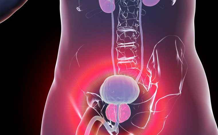 The Things Every Man Should Know About Prostate Cancer